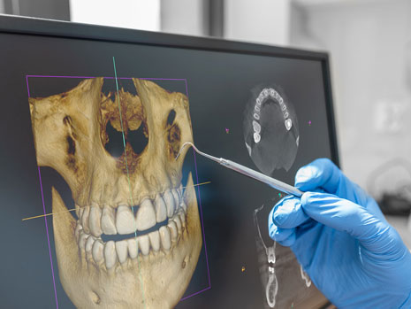 cbct imaging