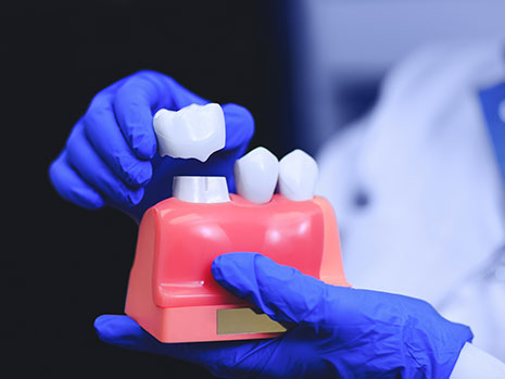 crown lengthening